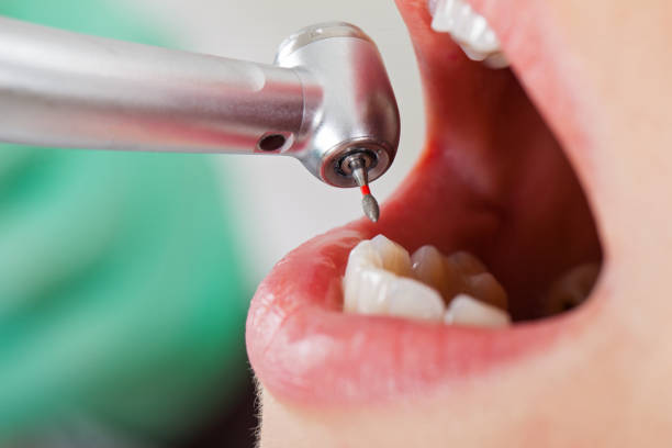 Best Tooth Infection Emergency Dentist  in , NV